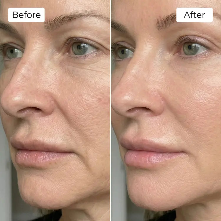 Rejuvena Dermal One - Advanced LED Light Therapy