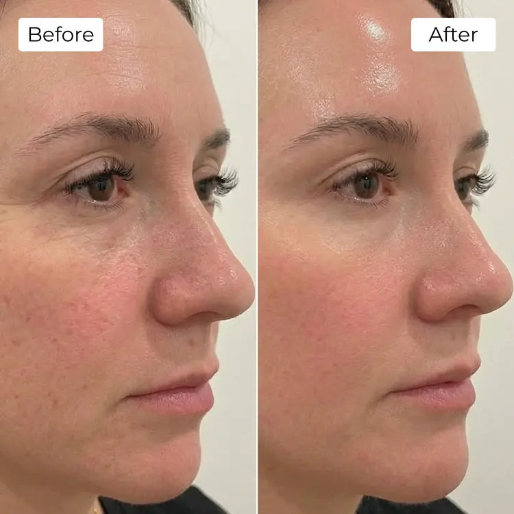 Rejuvena Dermal One - Advanced LED Light Therapy