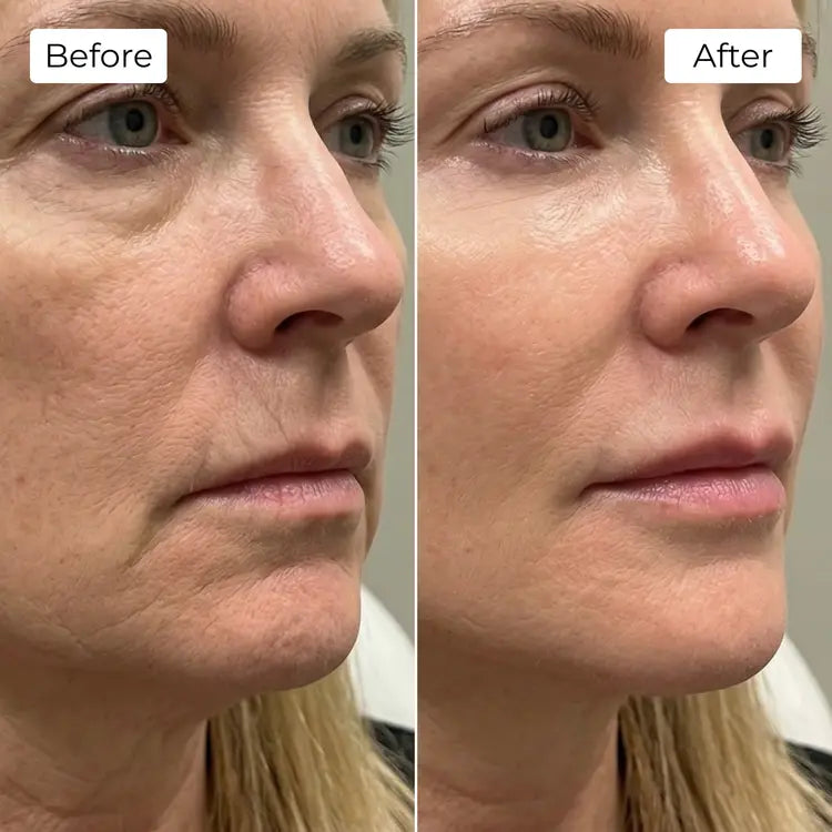Rejuvena Dermal One - Advanced LED Light Therapy