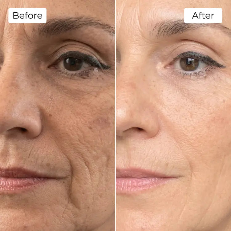Rejuvena Dermal One - Advanced LED Light Therapy
