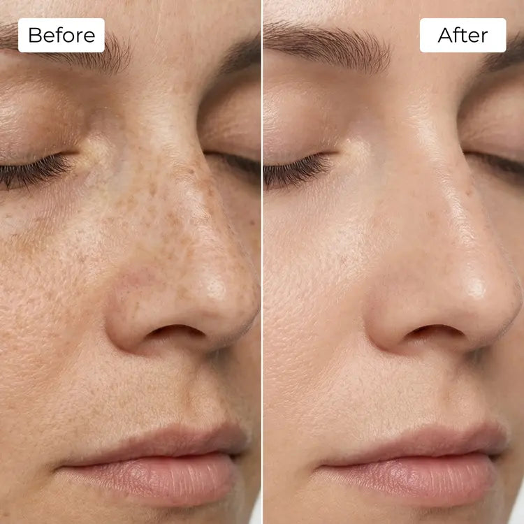 Rejuvena Dermal One - Advanced LED Light Therapy
