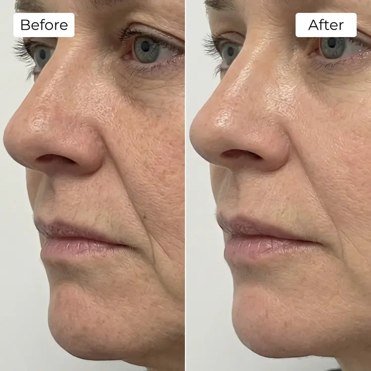 Rejuvena Dermal One - Advanced LED Light Therapy