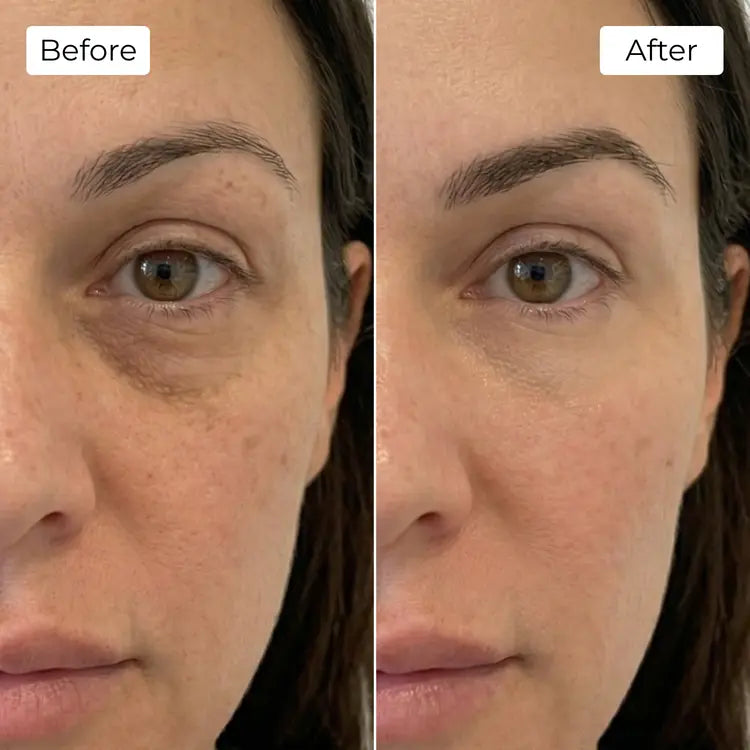 Rejuvena Dermal One - Advanced LED Light Therapy