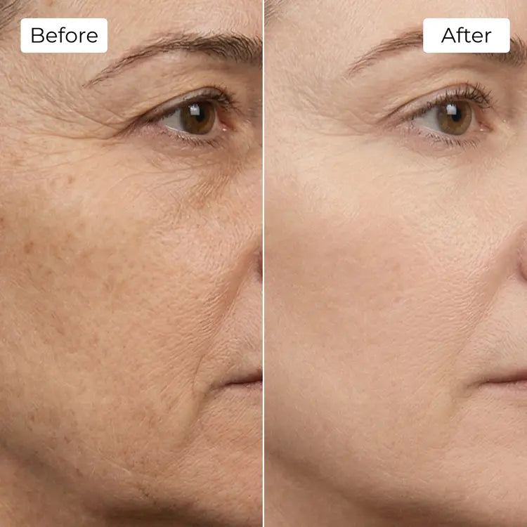 Rejuvena Dermal One - Advanced LED Light Therapy