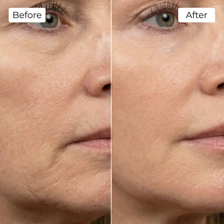 Rejuvena Dermal One - Advanced LED Light Therapy